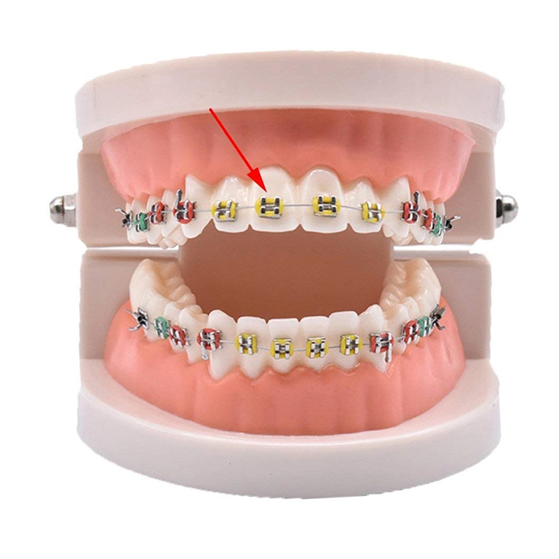 high quality dental orthodontic ligature ties transparent color elastic long type ligature tie
