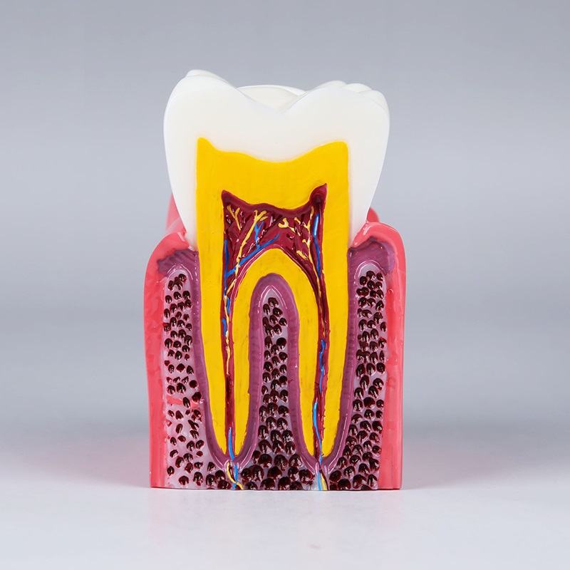 dental training caries model compares the healthy and caries tooth orthodontic dental practice teaching model