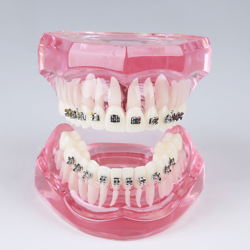 dental teeth study model M3001 dental orthodontics model with full metal brackets