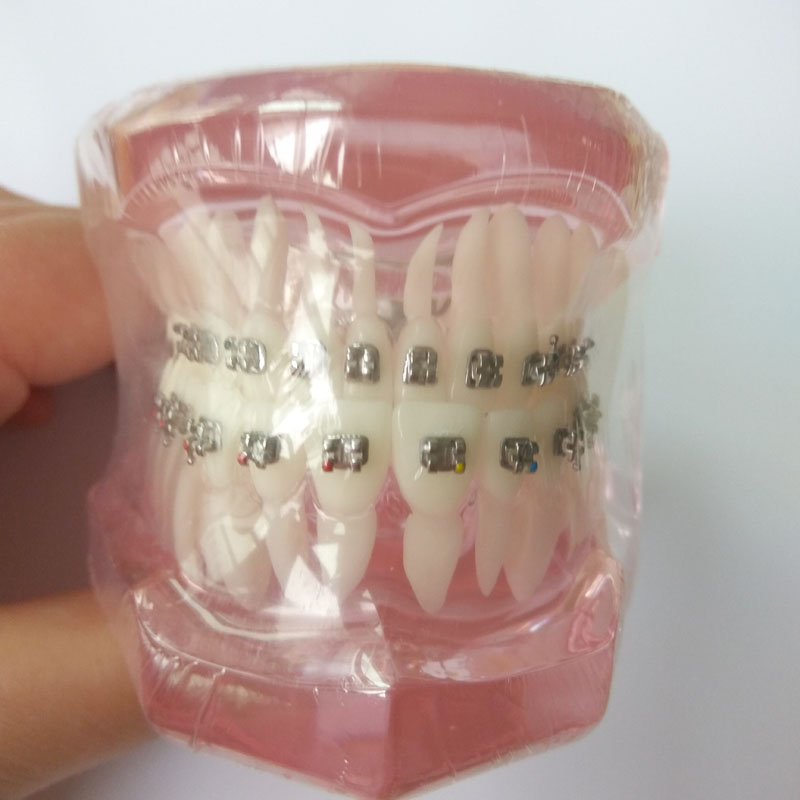 orthodontic dental M3001 metal bracket typodont adult teeth model demonstration practice wires education model