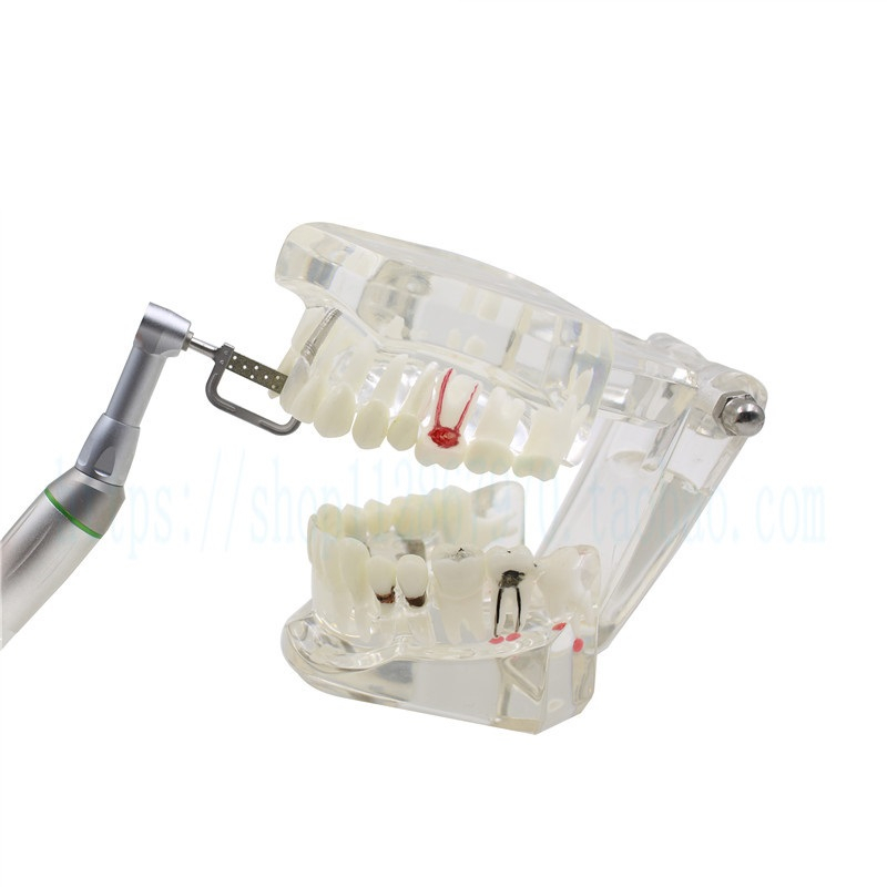 Dental Orthodontic IPR system stripping tools dental interproximal enamel reduction set reduction