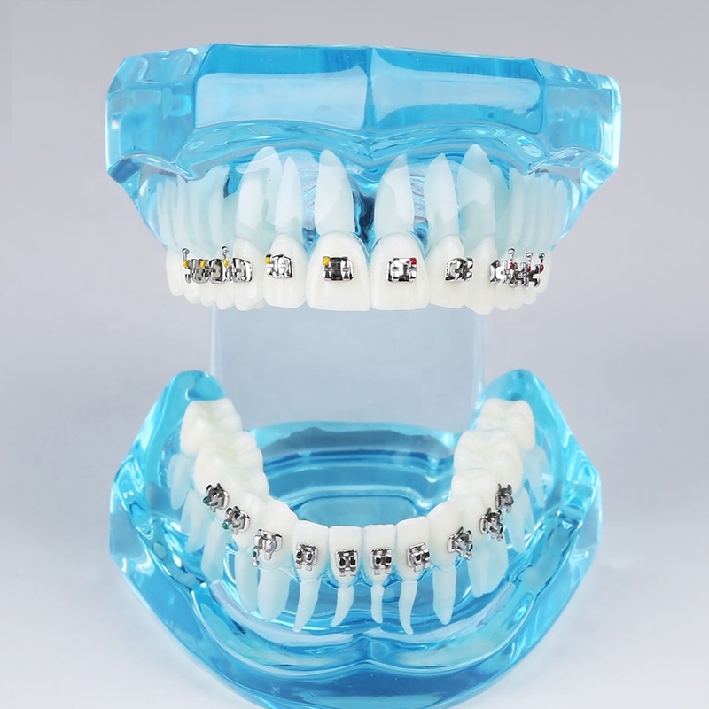 Factory Promotional Ligature Tucker Dental - orthodontic dental M3001 metal bracket typodont adult teeth model demonstration practice wires education model – Onice