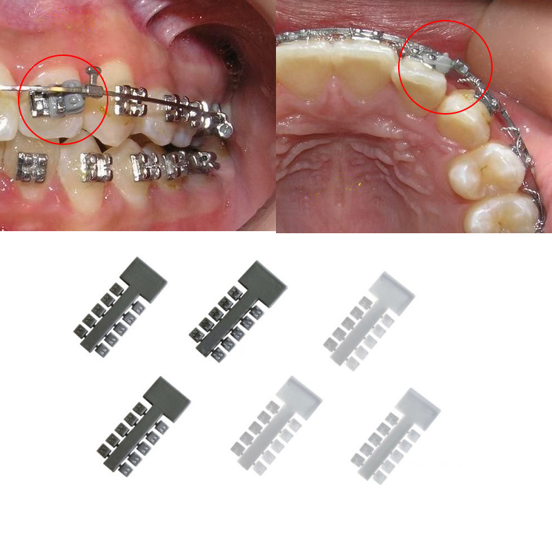dental elastomeric rotation wedge orthodontic rubber band dental transparent clear gray orthodontic elastic rotation wedges
