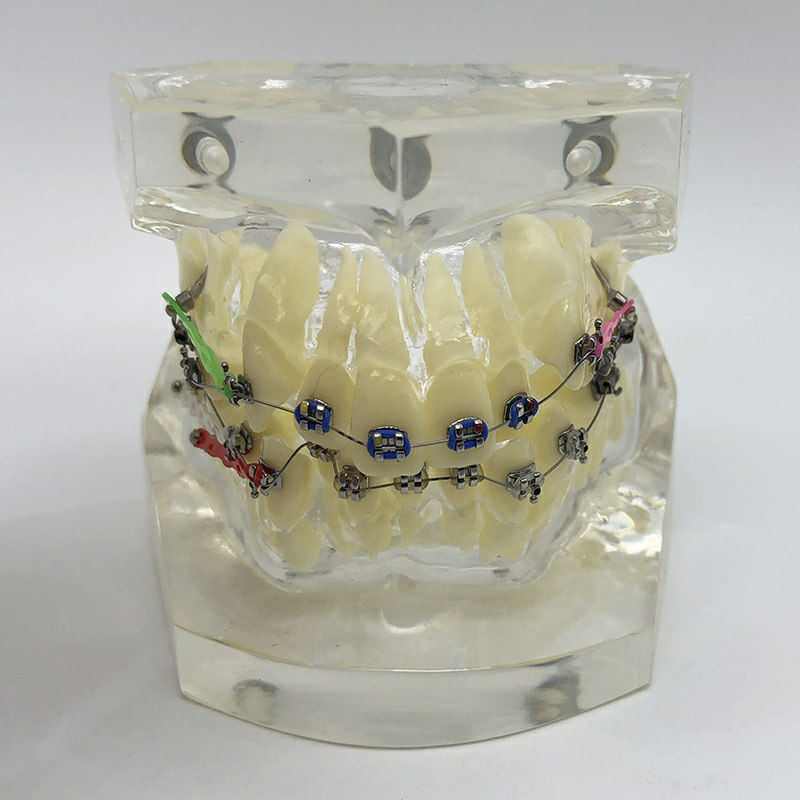 high quality dental orthodontic model for education dental tooth model M3005 with archwire bracket clear gum model