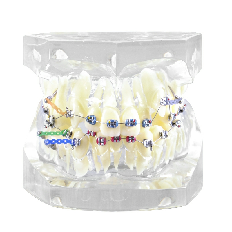dental orthodontic model with brackets and buccal tubes and ligature wire for practice dental instrument composite model
