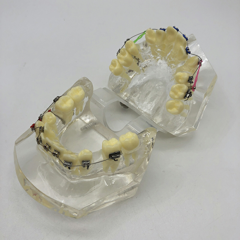 high quality dental orthodontic model for education dental tooth model M3005 with archwire bracket clear gum model