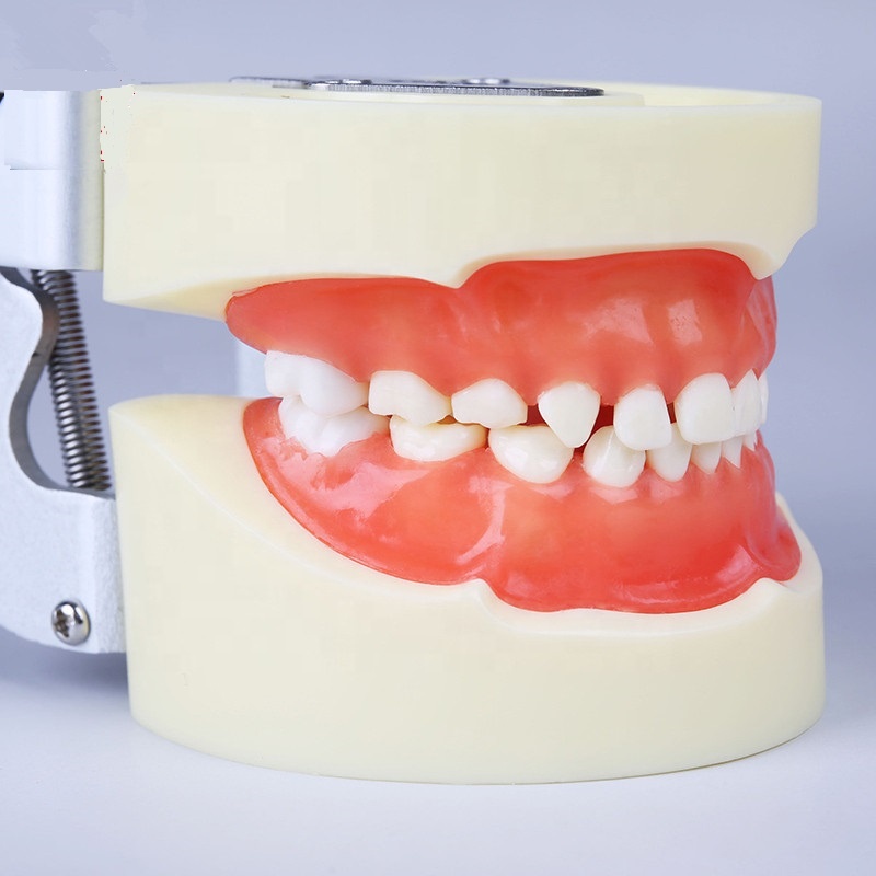 Reasonable price for Curette Instrument Dental - Standard pediatric practice model dental baby teeth model advance PVC children tooth model installed into manikin – Onice