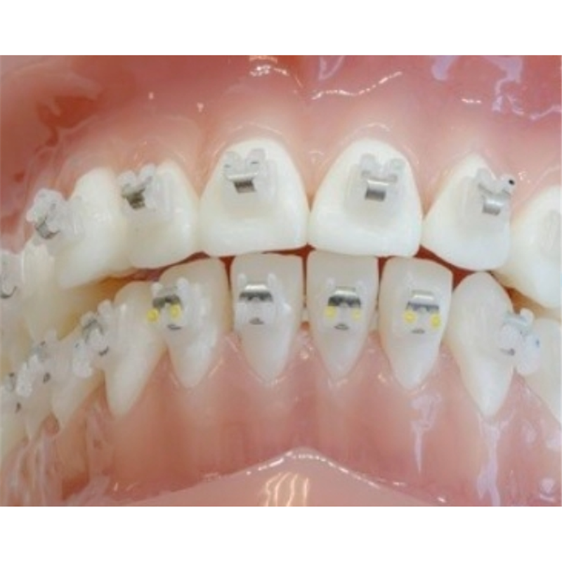 orthodontic dental marked ceramic self ligation brackets orthodontic dental material ceramic with metal self-ligating bracket